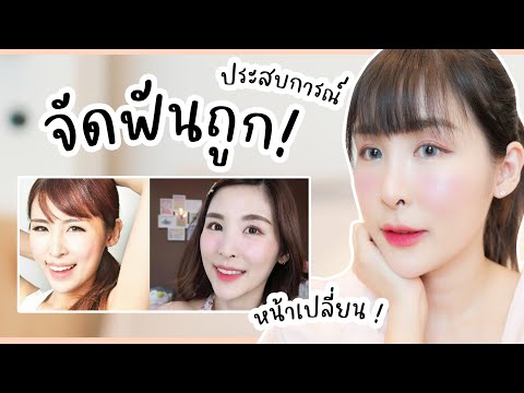 รีวิว-จัดฟัน-ราคาถูก!-เดือนละ- รีวิว-จัดฟัน-ราคาถูก!-เดือนละ-