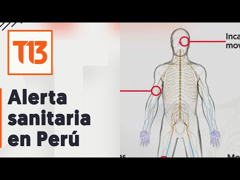 Alerta sanitaria en Perú por síndrome de Guillain-Barré