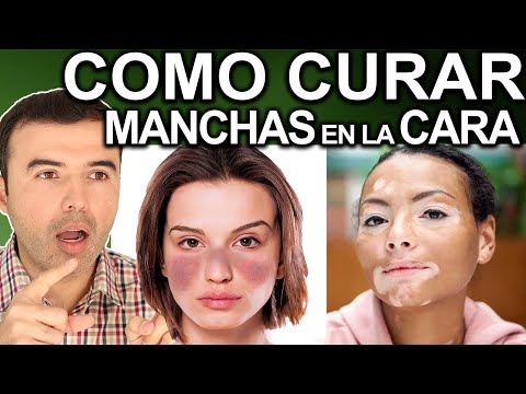 COMO ELIMINAR LAS MANCHAS DE TU CARA EN 3 PASOS 2025