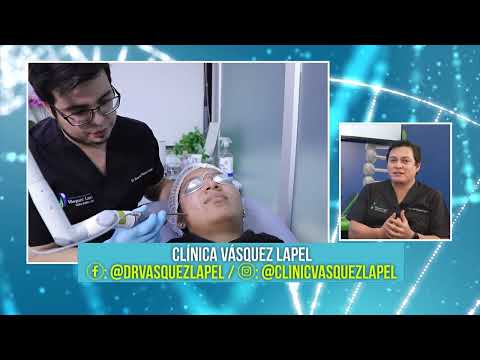 El Dr. Borda - ENE 22 - 3/4 - TRATAMIENTO LÁSER PARA EL ACNÉ | Willax