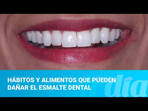 Hábitos y alimentos que pueden dañar el esmalte dental