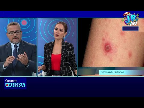 Viceministro de Salud Pública se pronuncia sobre los casos de sarampión y dengue en país