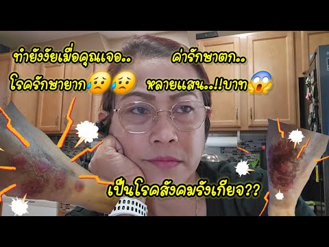 เมื่อคุณเป็นโรคที่รักษาไม่หาย