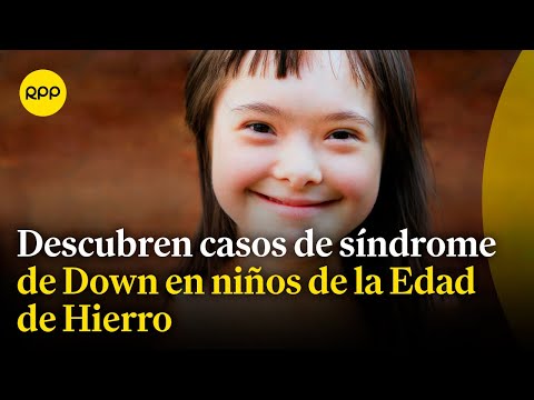 Descubrimiento científico: Encuentran niños con síndrome de Down en la edad de Hierro