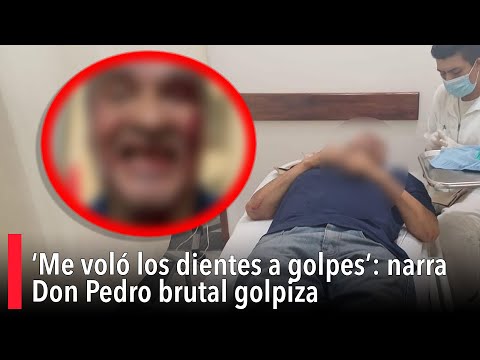 ‘Me volo? los dientes a golpes’: narra Don Pedro brutal golpiza