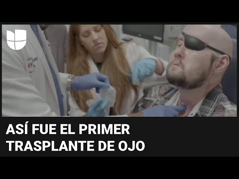 Un cable de alta tensión le quemó la cara: ahora es el primero en recibir un trasplante de ojo