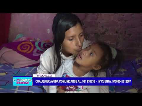 Trujillo: niña con microcefalia severa necesita apoyo económico
