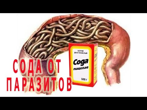 Паразит блоха википедия