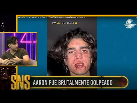 Aaron Mercury fue golpeado por ser bonito | MSQSNS