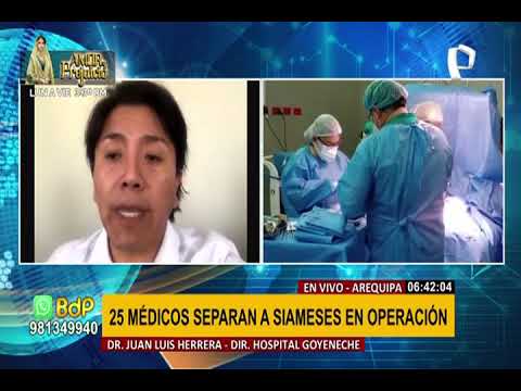 Arequipa: separan a bebés siameses unidos por la cadera tras exitosa operación