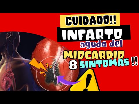 CUIDADO ? INFARTO AGUDO DE MIOCARDIO - 8 SÍNTOMAS A TOMAR ENC CUENTA !!!