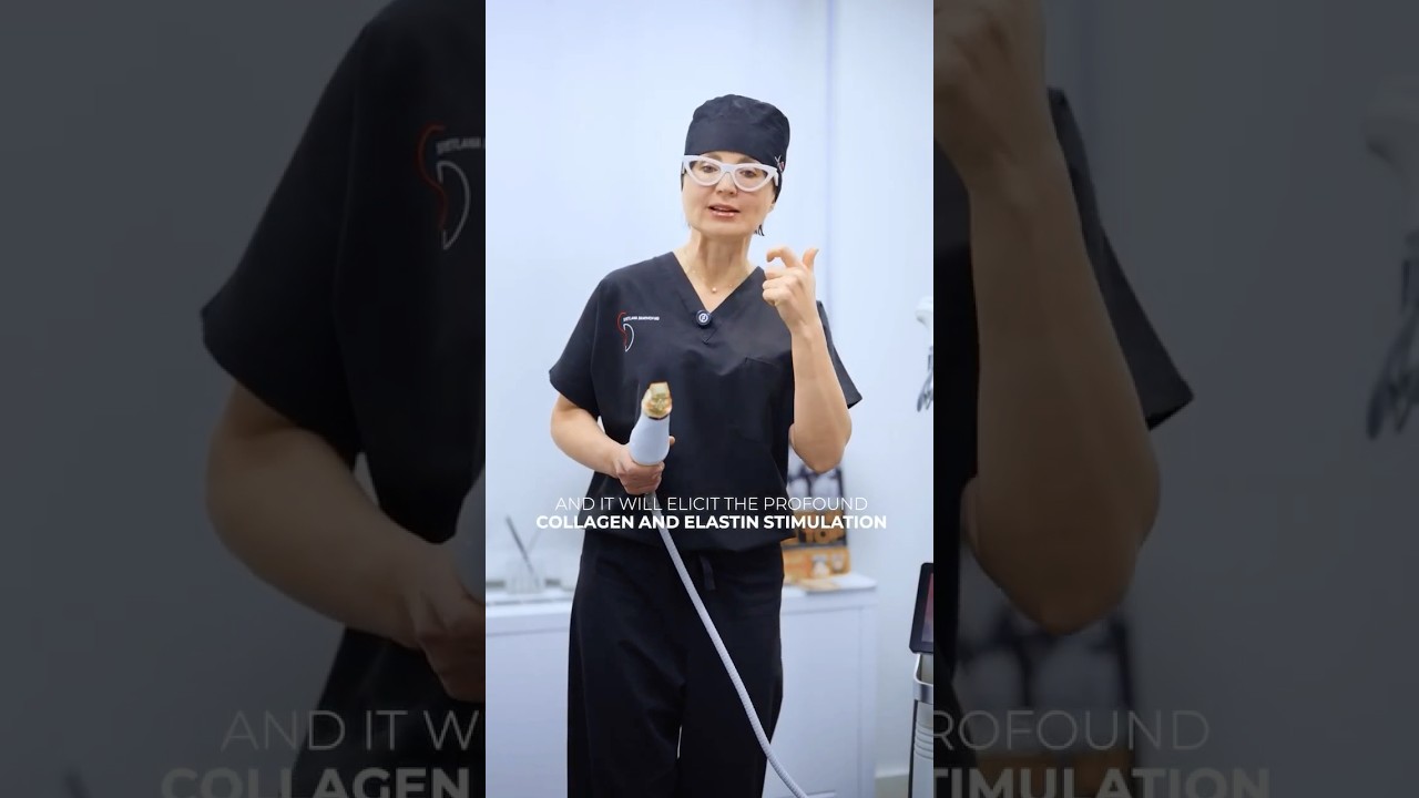 RF microneedling and CO2 laser resurfacing to treat the skin from the inside out