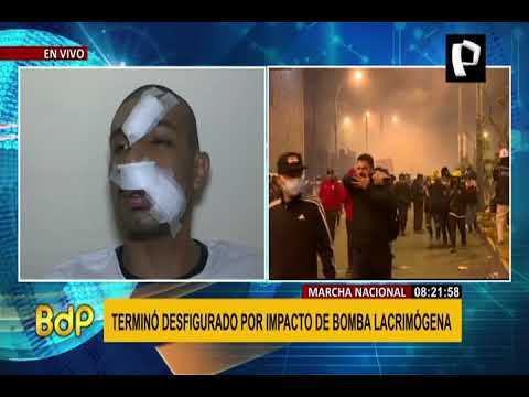 Olivares: Se ha abierto una herida entre la PNP y la ciudadanía y es muy peligroso