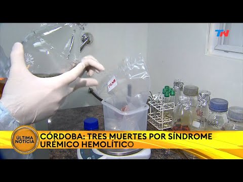 Córdoba: confirman tres muertes por Síndrome Urémico Hemolítico y nueve casos en lo que va del año