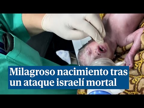 Nace un bebé en Gaza tras morir su madre en un ataque israelí