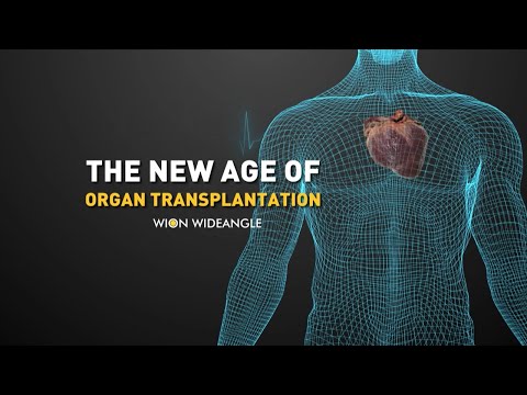 The new age of organ transplantation | WION Wideangle