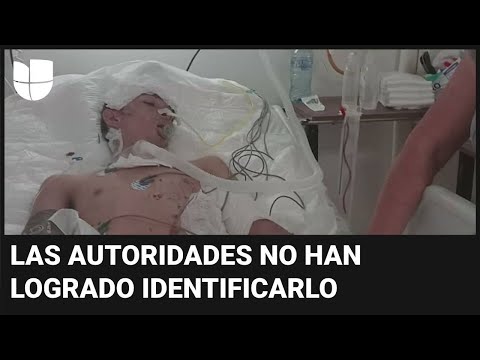 Migrante pierde las piernas tras caer del tren 'La Bestia': está inconsciente en hospital de México