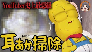 【耳垢の天才】YouTuber史上最悪級と言われた伝説の耳垢をもつ勇者が3年ぶりに耳掃除をします。