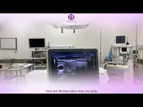 Khó tin: 1 lần can thiệp giải quyết ngay 3 bướu lành ??