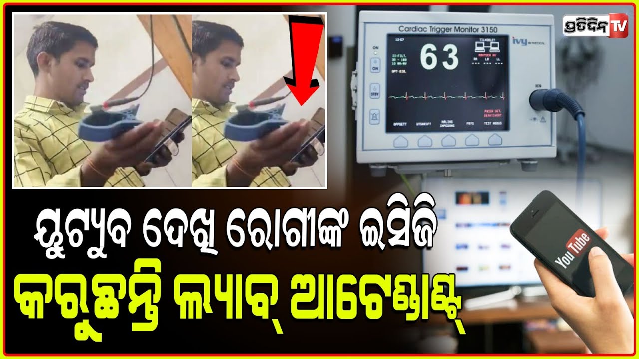 ୟୁଟ୍ୟୁବ୍ ଦେଖି ECG କଲେ ଲ୍ୟାବ୍ ଆଟେଣ୍ଡାଣ୍ଟ lab attendant performs ecg after watching youtube video!