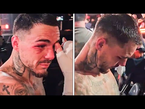 BATTERED & BRUISED George Kambosos IMMEDIATELY AFTER KNOCKOUT LOSS to Richardson Hitchins