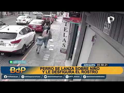 BDP Perro ataca a un niño en calle de Arequipa