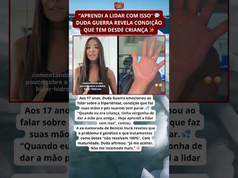 “Aprendi a lidar com isso” 💬 — Duda Guerra revela condição que tem desde criança ✨