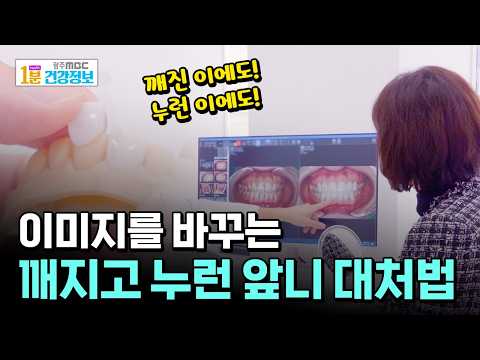 이미지를 바꾸는 깨지고 누런 앞니, 대처법은!? [🏥1분 건강정보]