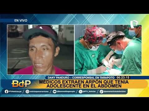 ¡Increíble historia de supervivencia! Joven se recupera tras accidente con arpón en Tarapoto