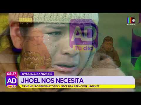 Jhoel nos necesita