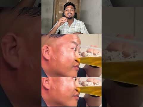 The Man Who Drinks Beer Through His Nose: <strong>Talent</strong> or Deadly Stunt?