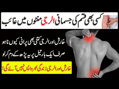 How to stop skin itching | Kharish ka rohani ilaj | Best waifa for itchy skin