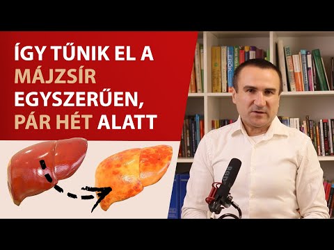 Így tűnik el a Májzsír egyszerűen, pár hét alatt