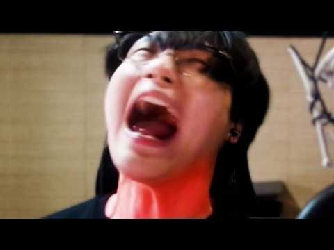 <strong>성대결절</strong> 왔습니다.