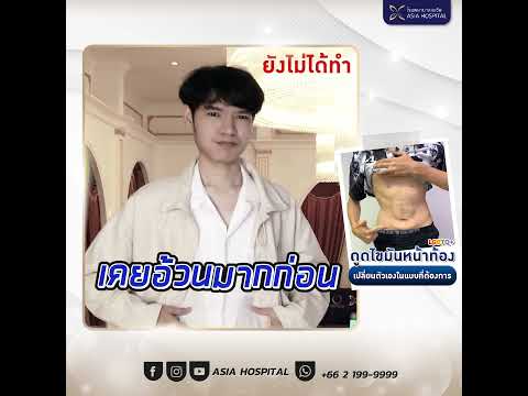 กำจัดพุงหมาน้อยโดยการดูดไขมัน