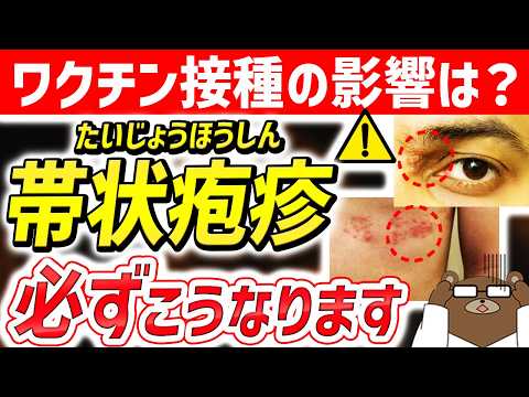 【危険】知らないと後悔する..急増している「帯状疱疹」の超意外な危険サイン。ワクチン接種の影響は？なぜ増加しているのか。恐ろしい「帯状疱疹の後遺症」とは。予防法はあるのか。医師が完全解説。