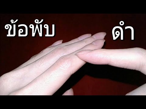 4วิธีแก้ข้อพับดำนิ้วมือ|H