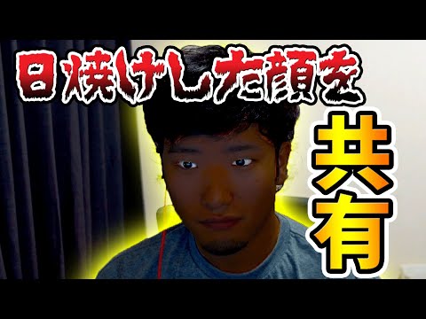 突然日焼けした顔を画面共有してみたｗｗ　【フォートナイト】