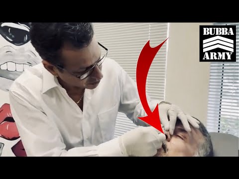 Doctor Repairs a Split Nostril - #TheBubbaArmy