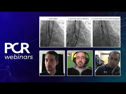 How to reduce permanent pacemaker (PPM) rate with cusp overlap technique? – Webinar