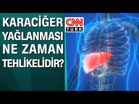 Karaciğer yağlanması ne zaman tehlikelidir?