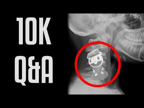 The 10K Q&A Extravaganza!