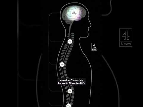 Musk seeks people for brain-implant trials