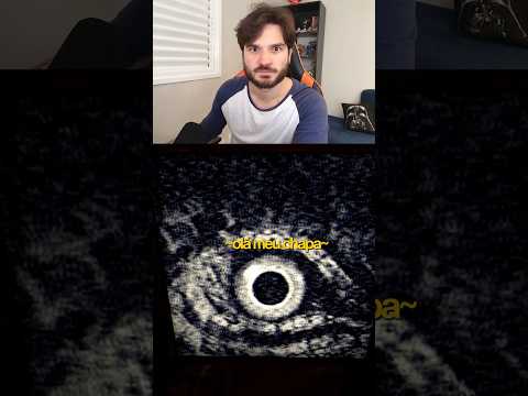 A FOTO MAIS BIZARRA DE IRON LUNG!