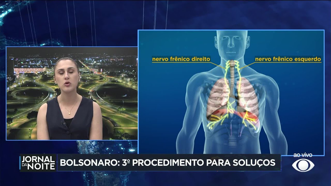 Bolsonaro passa por novo procedimento para tratar quadro de soluços