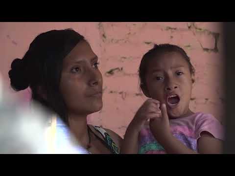 Ayuda Social: Madre clama ayuda para su pequeña que padece de microcefalia