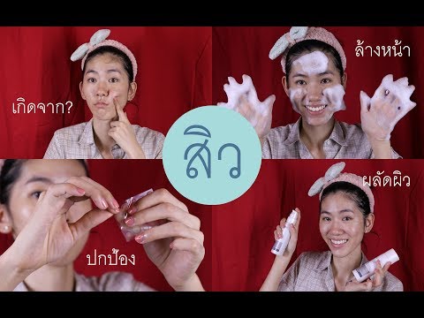 สารพัดเรื่องสิว│สาเหตุการป้อง