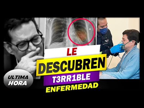 Desgarrador panorama:En sus Últimos días  Pepillo Origel y el TERR1BL3 estado d salud MUY crítico