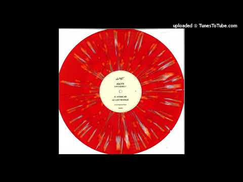 ANOTR-Lost Revenue (NAR002)