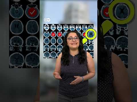 ¿Tienes miedo de padecer alzhéimer ¡La inteligencia artificial puede ayudar!